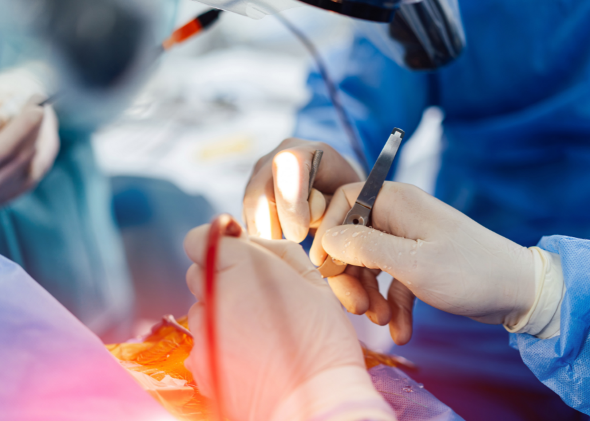 Diagnostic Laparoscopy