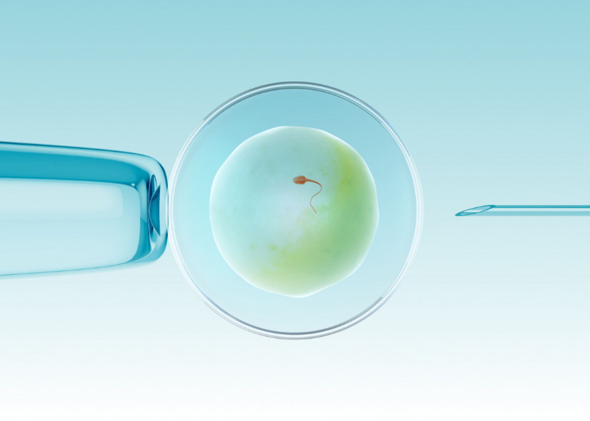 In Vitro Fertilization (IVF)